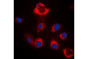 Immunofluorescent analysis of BAX staining in HeLa cells. (BAX Antikörper  (Center))
