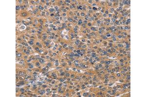 Immunohistochemistry (IHC) image for anti-Natural Cytotoxicity Triggering Receptor 2 (NCR2) antibody (ABIN2432791) (NKp44/NCR2 Antikörper)