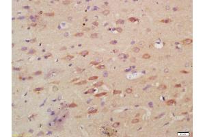 Formalin-fixed and paraffin embedded rat brain labeled with Anti-MPO Polyclonal Antibody, Unconjugated (ABIN1387491) at 1:200, followed by conjugation to the secondary antibody and DAB staining (Myeloperoxidase Antikörper  (AA 678-745))
