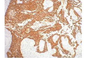 Immunohistochemistry (IHC) image for anti-Keratin 16 (KRT16) antibody (ABIN3178609) (KRT16 Antikörper)