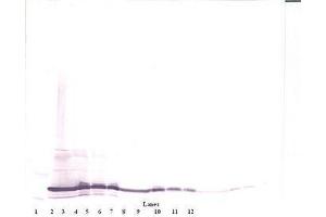 Image no. 2 for anti-Interleukin 17F (IL17F) antibody (ABIN465701) (IL17F Antikörper)