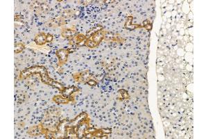 ABIN7095174 and ABIN7099230 at 1/100 staining mouse kidney tissue by IHC-P.