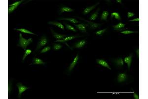 Immunofluorescence of purified MaxPab antibody to DUSP12 on HeLa cell. (DUSP12 Antikörper  (AA 1-340))