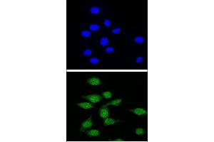 Confocal immunofluorescent analysis of AIRE Antibody (Center) (ABIN655031 and ABIN2844662) with 293 cell followed by Alexa Fluor® 488-conjugated goat anti-rabbit lgG (green). (AIRE Antikörper  (AA 64-92))