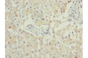 Immunohistochemistry of paraffin-embedded human liver tissue using ABIN7142330 at dilution of 1:100 (AKR1D1 Antikörper  (AA 1-200))