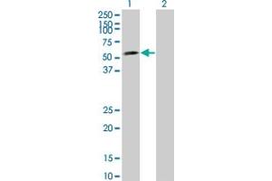 Western Blot analysis of LEF1 expression in transfected 293T cell line by LEF1 monoclonal antibody (M08), clone 2E2. (LEF1 Antikörper  (AA 33-138))
