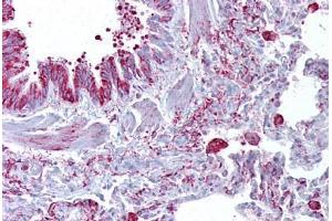Anti-GABRB3 antibody IHC staining of human lung.