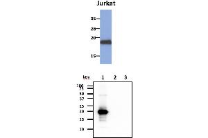 The cell lysates of Jurkat (30ug) were resolved by SDS-PAGE, transferred to PVDF membrane and probed with anti-human MAFK antibody (1:1000). (MAFK Antikörper)