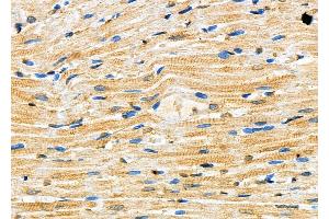 ABIN6257178 and ABIN6273623 at 1/100 staining Rat heart tissue by IHC-P.