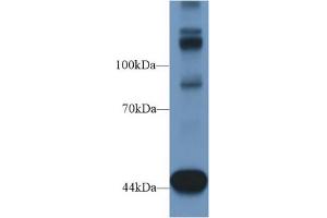 Western Blot; Sample: Mouse Heart lysate; Primary Ab: 1µg/ml Rabbit Anti-Human TNS1 Antibody Second Ab: 0.