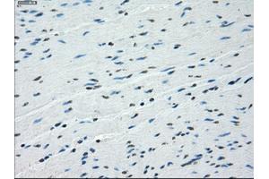 Image no. 3 for anti-Budding Uninhibited By Benzimidazoles 1 Homolog beta (Yeast) (BUB1B) antibody (ABIN1496996) (BUB1B Antikörper)