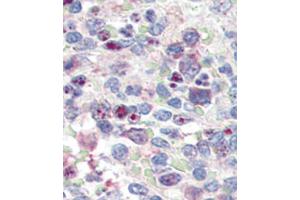 Formalin-fixed and paraffin-embedded human Spleen tissue reacted with SNAI1 antibody (N-term D24) (ABIN388809 and ABIN2850429) , which was peroxidase-conjugated to the secondary antibody, followed by AEC staining. (SNAIL Antikörper  (N-Term))