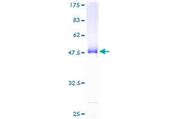 BID Protein (AA 1-195) (GST tag)