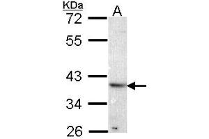 Western Blotting (WB) image for anti-ATPase, H+ Transporting, Lysosomal Accessory Protein 2 (ATP6AP2) (AA 146-320) antibody (ABIN467627) (ATP6AP2 Antikörper  (AA 146-320))