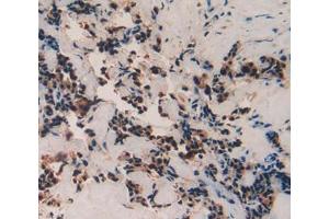 Immunohistochemistry (IHC) image for anti-TAF12 RNA Polymerase II, TATA Box Binding Protein (TBP)-Associated Factor, 20kDa (TAF12) (AA 1-161) antibody (ABIN1860675)