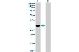 Western Blot analysis of NQO1 expression in transfected 293T cell line by NQO1 MaxPab polyclonal antibody. (NQO1 Antikörper  (AA 1-274))