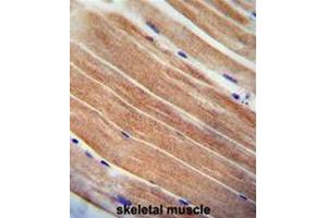 CST9 antibody (C-term) immunohistochemistry analysis in formalin fixed and paraffin embedded human skeletal muscle followed by peroxidase conjugation of the secondary antibody and DAB staining. (CST9 Antikörper  (C-Term))