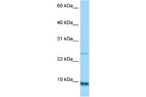 WB Suggested Anti-SPRR1A Antibody Titration: 1. (SPRR1A Antikörper  (Middle Region))