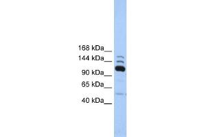 WB Suggested Anti-POLR3B Antibody Titration:  0. (POLR3B Antikörper  (C-Term))