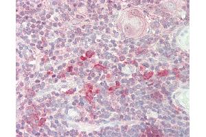 Human Thymus: Formalin-Fixed, Paraffin-Embedded (FFPE). (RPA1 Antikörper  (AA 359-408))