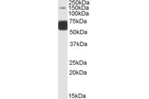 ABIN334410 (1µg/ml) staining of Human Brain (Cerebellum) lysate (35µg protein in RIPA buffer). (GRIK1 Antikörper  (Internal Region))