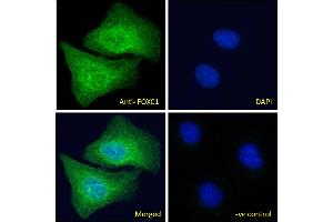 ABIN185028 Immunofluorescence analysis of paraformaldehyde fixed U2OS cells, permeabilized with 0.