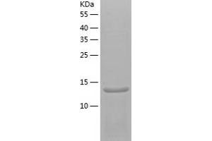 Western Blotting (WB) image for SH2 Domain Containing 1A (SH2D1A) (AA 1-128) protein (His tag) (ABIN7125076) (SH2D1A Protein (AA 1-128) (His tag))