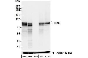Western Blotting (WB) image for anti-Interferon, gamma-Inducible Protein 16 (IFI16) (AA 350-400) antibody (ABIN7795821)