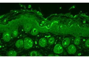 Immunohistochemistry (IHC) image for anti-Ubiquitin (Ub) antibody (ABIN361831)