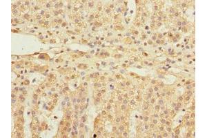 Immunohistochemistry of paraffin-embedded human adrenal gland tissue using ABIN7152154 at dilution of 1:100 (EIF3F Antikörper  (AA 88-357))