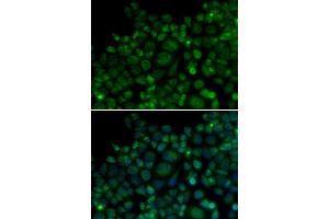 Immunofluorescence analysis of MCF7 cell using TLR7 antibody. (TLR7 Antikörper  (AA 30-230))