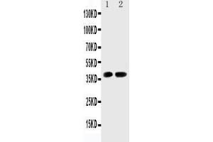Anti-Cdk6 antibody, Western blotting Lane 1: Rat Testis Tissue Lysate Lane 2: Rat Lung Tissue Lysate