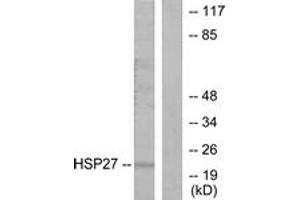 Western Blotting (WB) image for anti-Heat Shock 27kDa Protein 1 (HSPB1) (AA 5-54) antibody (ABIN2889005) (HSP27 Antikörper  (AA 5-54))