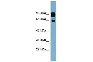 WB Suggested Anti-CLPTM1L Antibody Titration:  0. (CLPTM1L Antikörper  (Middle Region))