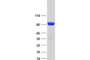 Validation with Western Blot (BIN1 Protein (Transcript Variant 8) (Myc-DYKDDDDK Tag))