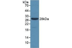 Detection of Recombinant a2M, Human using Monoclonal Antibody to Alpha-2-Macroglobulin (a2M) (alpha 2 Macroglobulin Antikörper  (AA 616-856))