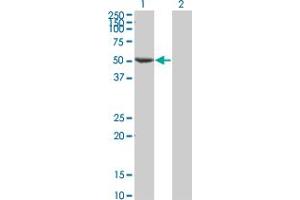 Western Blot analysis of FLI1 expression in transfected 293T cell line by FLI1 monoclonal antibody (M05), clone 1F6.