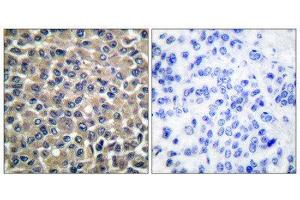 Immunohistochemistry (IHC) image for anti-Matrix Metallopeptidase 19 (MMP19) (N-Term) antibody (ABIN1848680) (MMP19 Antikörper  (N-Term))