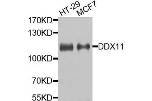 Western blot analysis of extracts of HT29 and MCF7 cells, using DDX11 antibody. (DDX11 Antikörper)
