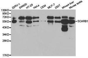Western Blotting (WB) image for anti-Scavenger Receptor Class B, Member 1 (SCARB1) antibody (ABIN1874696) (SCARB1 Antikörper)