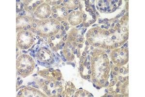 Immunohistochemistry of paraffin-embedded Rat kidney using H6PD Polyclonal Antibody at dilution of 1:200 (40x lens).