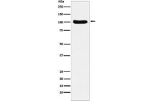 Western blot analysis of Cellular Apoptosis Susceptibility expression in Ramos cell lysate. (Rekombinanter Exportin 2 Antikörper)