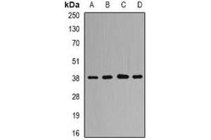 Western blot analysis of QKI expression in HL60 (A), Hela (B), mouse brain (C), rat liver (D) whole cell lysates. (QKI Antikörper)