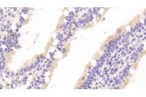 Immunohistochemistry (IHC) image for anti-Caspase 10, Apoptosis-Related Cysteine Peptidase (CASP10) (AA 223-459) antibody (ABIN7443104)