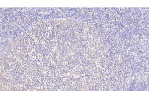 Detection of SRGN in Human Lymph node Tissue using Polyclonal Antibody to Serglycin (SRGN) (SRGN Antikörper  (AA 28-158))