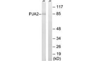 Western blot analysis of extracts from Jurkat cells, using PJA2 Antibody. (PJA2 Antikörper  (AA 141-190))