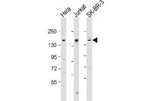 All lanes : Anti-FANCD2 Antibody (Center) at 1:2000 dilution Lane 1: Hela whole cell lysates Lane 2: Jurkat whole cell lysates Lane 3: SK-BR-3 whole cell lysates Lysates/proteins at 20 μg per lane. (FANCD2 Antikörper  (AA 893-927))