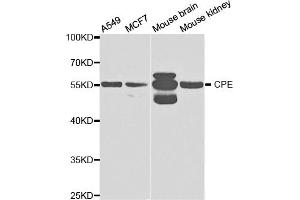 Western blot analysis of extracts of various cell lines, using CPE antibody (ABIN5973172) at 1/1000 dilution. (CPE Antikörper)