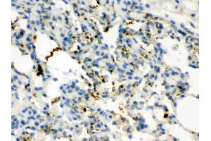 Calcitonin was detected in paraffin-embedded sections of rat lung tissues using rabbit anti- Calcitonin Antigen Affinity purified polyclonal antibody (Catalog # ) at 1 ? (CGRP Antikörper  (C-Term))