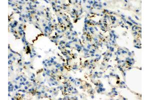 Immunohistochemistry (IHC) image for anti-Calcitonin-Related Polypeptide alpha (CALCA) (AA 83-119), (C-Term) antibody (ABIN4886497)